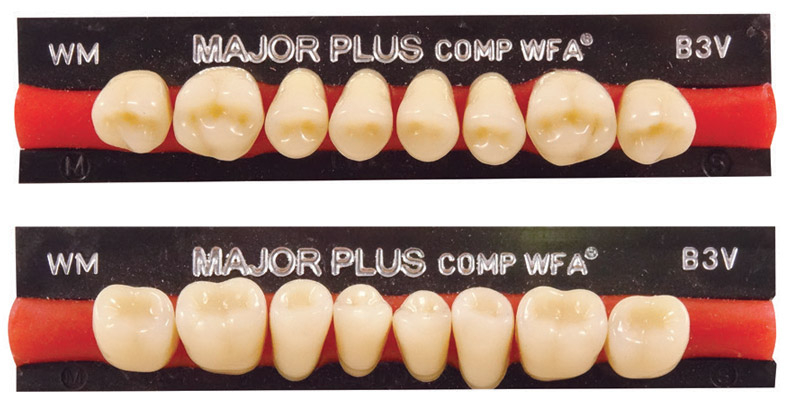 MAJOR PLUS COMP Postérieures WFA  Major 70115-b4-ws-b